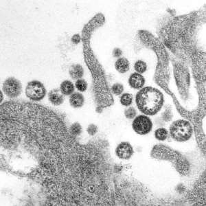 GHS caution practitioners, public against Lassa fever outbreak in West Africa