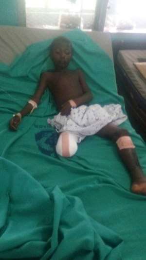 Grandfather cuts leg of grandson for alleged stealing