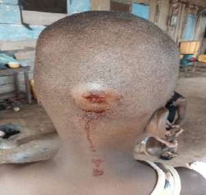 Takoradi: Man clubs sons head thinking he's a wizard, blames his son for his joblessness