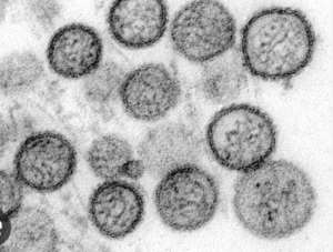 What Is Hantavirus? Everything You Need to Know And What Happened on the MV Hondius