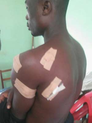 Policemen Beats And Stabs 30 Years Old Man In Sunyani