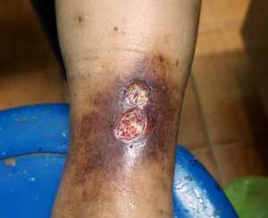 Slay Queens legs rotten after popular politician constantly licked, k*ssed them