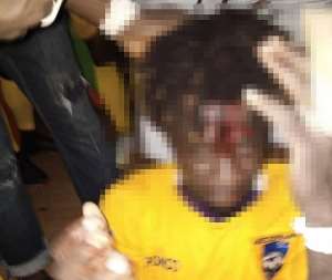 MTN FA Cup: Medeama players attacked, team bus smashed by angry Karela United fans Photos