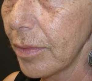 Tips To Delay Skin Ageing