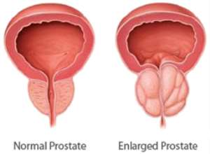 You dont know the Prostate Gland until you read this Masterpiece!