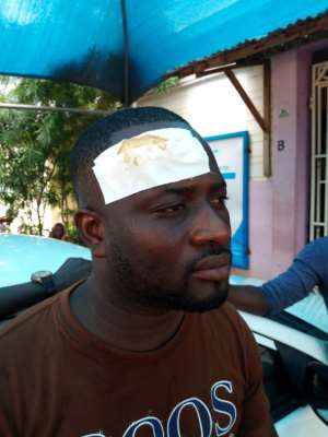 NDC member allegedly brutalized by NPP thugs in Hohoe
