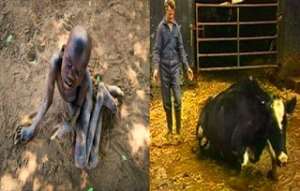 A child suffering from nodding disease syndrome and a cow suffering from mad cow disease. Is there any link between the two?