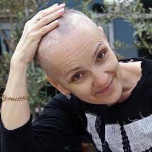 Complete hair loss after chemo, yet breast cancer survivors always wear a beautiful smile on the face