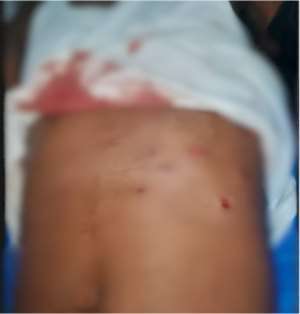 Two sustain gun wounds in Mankrong Nkwanta robbery