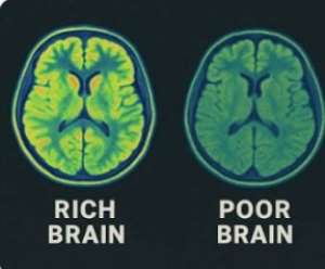 Scientists Confirm: Chronic Stress From Poverty Can Damage the Brain