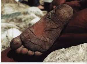 The Man Without Shoes