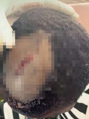 Trader remanded for allegedly assaulting 10-year-old daughter with cutlass