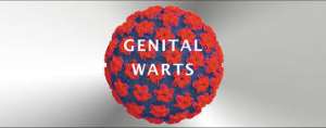 Genital Warts? Here's All You Need To Know About It