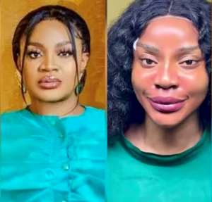 If  You Dont Like It, Change It – Uche Ogbodo Unveils New Look After Facial Rejuvenation