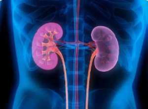 Kidney Disease in Ghana: From Silent Killer to National Emergency