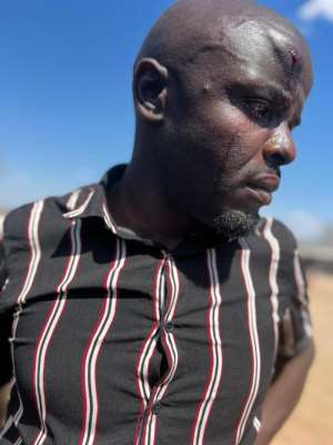 Zimbabwean journalist Tongai Mwenje was one of four journalists beaten by supporters of the country's ruling ZANU-PF party on August 25. Photo courtesy Tongai Mwenje