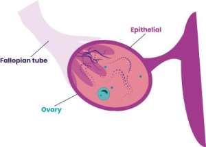Low AMH in Women Under 30: Why Is Ovarian Reserve Declining Earlier