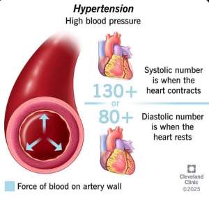 I’m Not Sick — Why Should I Check My Blood Pressure?