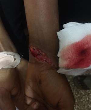 Hand of one of the victims was slashed before took her hand bag