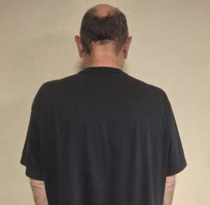 Third Drug Mule in 3 Weeks: R2m Heroin Found in SA Man’s Luggage at OR Tambo