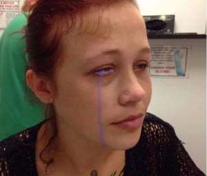 Botched Eyeball Tattoo Leaves Woman Crying Purple Tears