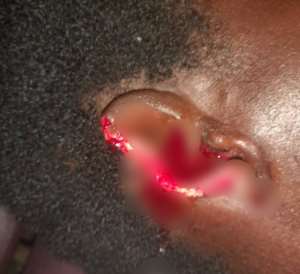Man ‘chews’ off wifes ear in scuffleat Dambai