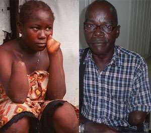 Amputees Life. After Sierra Leones 11 years Civil War