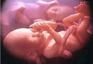 Unsafe abortion leading cause of birth complications - Nurse