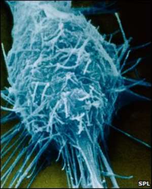 Neuroblastoma affects the nervous system