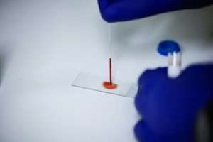 Misunderstanding Malaria Treatment Is Creating Problems for Its Fight