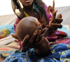 A malnourished child in the Sahel region in 2010.  By Sia Kambou AFPFile