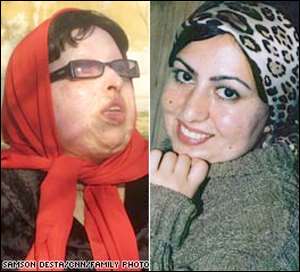 Blind Woman Demands Acid In Attacker's Eyes