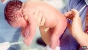 How to prevent birth defects