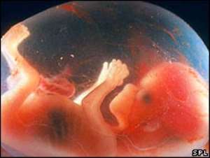 Foetus at 14 weeks