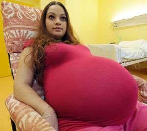 Alexandra Kinova will have a Caesarean section on Sunday to deliver her five babies (2)