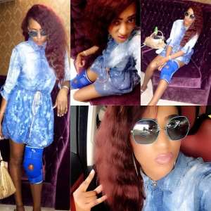 Rukky Sandra Suffers Injured Ankle, Walks With Support