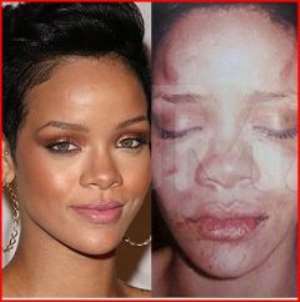 Singer Rihanna was assaulted by her former boyfriend Chris Brown