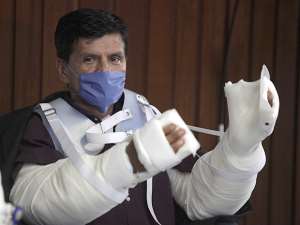 The Mexican, Granados with 2 Transplanted Arms