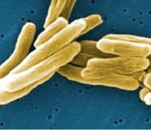 Ashanti leads in tuberculosis cases in Ghana