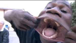 Francisco Joaquims mouth can be stretched more than six-and-a-half inches wide