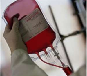Ebola: Over 60 blood samples proved negative in Ghana