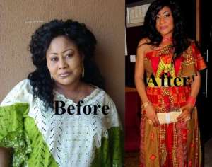 I am Not Ill, I Have Been Battling with My Weight for 10years- Ngozi Ezeonu