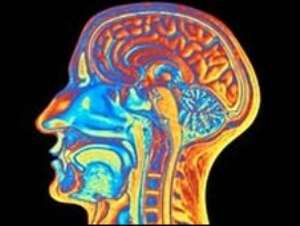 'People-person' brain area found
