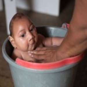 More Babies Born With Birth Defects In Brazil