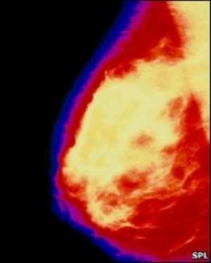 Breast regrowth trial planned