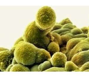 Genetics appear to dictate how the cancer behaves