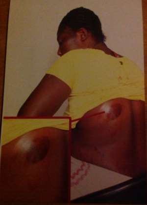 Obaa Yaa, Showing Her Wounds
