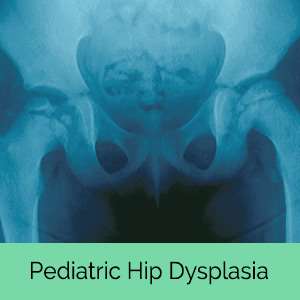 Surgical Treatment in India for Developmental Dysplasia of Hip With IndianMedTrip