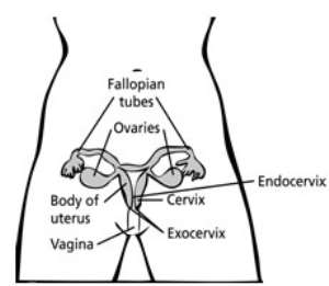 What is cervical cancer?