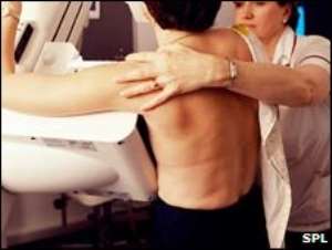 Women with denser breasts had a 21% risk of cancer recurrence.